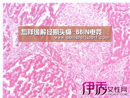 怎样缓解经期头痛-BBIN电竞(图3) BBIN真人